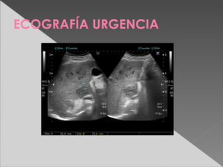 ECOGRAFÍA URGENCIA
 