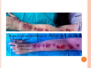    Haga clic para modificar el estilo de texto del patrón
       Segundo nivel
           Tercer nivel
              Cuarto nivel

                  Quinto nivel
 