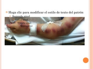    Haga clic para modificar el estilo de texto del patrón
       Segundo nivel
           Tercer nivel
              Cuarto nivel

                  Quinto nivel
 
