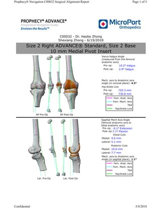 C00032 - Dr. Haobo Zhong
Shexiang Zhong - 6/19/2018
Size 2 Right ADVANCE® Standard, Size 2 Base
10 mm Medial Pivot Insert
AP Pre-Op AP Post-Op
Varus-Valgus Angle
(measured from the femoral
anatomic axis)
Pre-op: 10.2° Valgus
Post-op: 2.9° Valgus
Mech. axis to Anatomic axis
angle (in coronal plane): 4.3°
Hip-Ankle Line
Pre-op: 725.3 mm
Post-op: 730.8 mm
Fem. Anat. Axis
Fem. Mech. Axis
TEA
Hip/Ankle Line
Lat. Pre-Op Lat. Post-Op
Sagittal Mech Axis Angle
(femoral anatomic axis to
tibial anatomic axis)
Pre-op: -9.1° Extension
Post-op:7.1° Flexion
Distal Cuts
Medial: 9.0 mm
Lateral: 5.1 mm
Posterior Cuts
Medial: 10.0 mm
Lateral: 7.7 mm
Mech. axis to Anatomic axis
angle (in sagittal plane): 1.1°
Fem. Anat. Axis
Fem. Mech. Axis
TEA
Hip/Ankle Line
Page 1 of 5Prophecy® Navigation C00032 Surgical Alignment Report
5/8/2018Confidential
 
