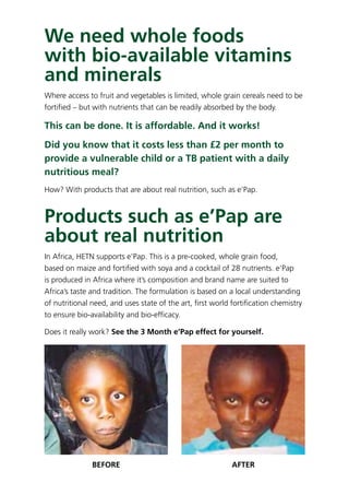 We need whole foods
with bio-available vitamins
and minerals
Where access to fruit and vegetables is limited, whole grain cereals need to be
fortiﬁed – but with nutrients that can be readily absorbed by the body.
This can be done. It is affordable. And it works!
Did you know that it costs less than £2 per month to
provide a vulnerable child or a TB patient with a daily
nutritious meal?
How? With products that are about real nutrition, such as e’Pap.
Products such as e’Pap are
about real nutrition
In Africa, HETN supports e’Pap. This is a pre-cooked, whole grain food,
based on maize and fortiﬁed with soya and a cocktail of 28 nutrients. e’Pap
is produced in Africa where it’s composition and brand name are suited to
Africa’s taste and tradition. The formulation is based on a local understanding
of nutritional need, and uses state of the art, ﬁrst world fortiﬁcation chemistry
to ensure bio-availability and bio-efﬁcacy.
Does it really work? See the 3 Month e’Pap effect for yourself.
BEFORE AFTER
 