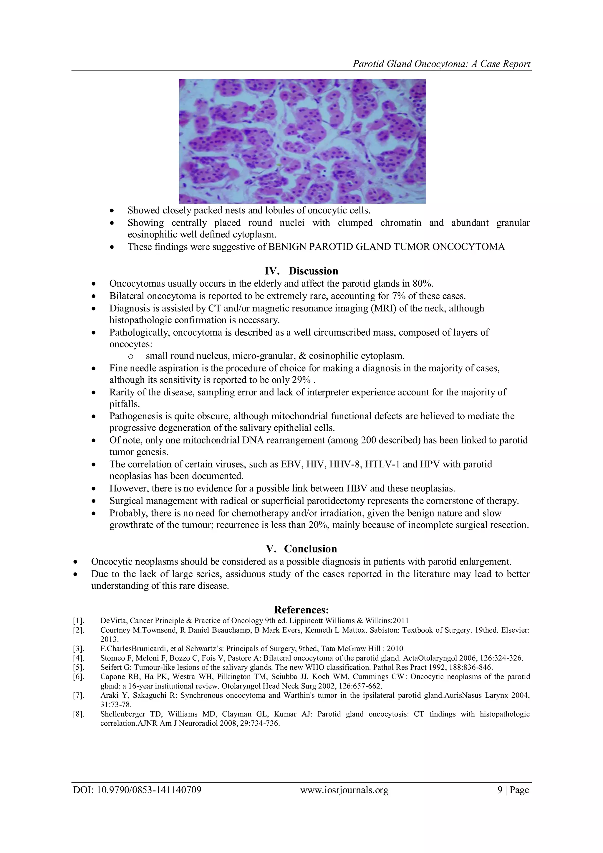 Parotid Gland Oncocytoma: A Case Report | PDF