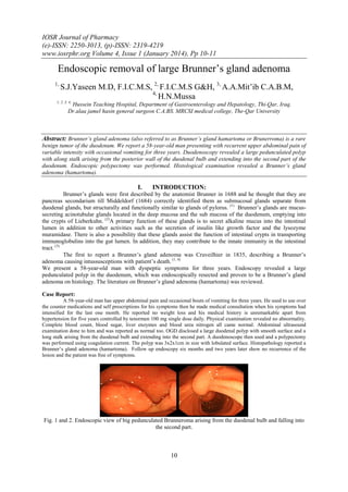 IOSR Journal of Pharmacy
(e)-ISSN: 2250-3013, (p)-ISSN: 2319-4219
www.iosrphr.org Volume 4, Issue 1 (January 2014), Pp 10-11

Endoscopic removal of large Brunner’s gland adenoma
1,

S.J.Yaseen M.D, F.I.C.M.S, 2, F.I.C.M.S G&H, 3, A.A.Mit’ib C.A.B.M,
4,
H.N.Mussa

1, 2, 3, 4,

Hussein Teaching Hospital, Department of Gastroenterology and Hepatology, Thi-Qar, Iraq.
Dr.alaa jamel hasin general surgeon C.A.BS. MRCSI medical college, The-Qar University

Abstract: Brunner’s gland adenoma (also referred to as Brunner’s gland hamartoma or Brunerroma) is a rare
benign tumor of the duodenum. We report a 58-year-old man presenting with recurrent upper abdominal pain of
variable intensity with occasional vomiting for three years. Duodenoscopy revealed a large pedunculated polyp
with along stalk arising from the posterior wall of the duodenal bulb and extending into the second part of the
duodenum. Endoscopic polypectomy was performed. Histological examination revealed a Brunner’s gland
adenoma (hamartoma).

I.

INTRODUCTION:

Brunner’s glands were first described by the anatomist Brunner in 1688 and he thought that they are
pancreas secondarium till Middeldorf (1684) correctly identified them as submucosal glands separate from
duodenal glands, but structurally and functionally similar to glands of pylorus. (1) Brunner’s glands are mucussecreting acinotubular glands located in the deep mucosa and the sub mucosa of the duodenum, emptying into
the crypts of Lieberkuhn. (2)A primary function of these glands is to secret alkaline mucus into the intestinal
lumen in addition to other activities such as the secretion of insulin like growth factor and the lysozyme
muramidase. There is also a possibility that these glands assist the function of intestinal crypts in transporting
immunoglobulins into the gut lumen. In addition, they may contribute to the innate immunity in the intestinal
tract. (3)
The first to report a Brunner’s gland adenoma was Cruveilhier in 1835, describing a Brunner’s
adenoma causing intussusceptions with patient’s death. (1, 4)
We present a 58-year-old man with dyspeptic symptoms for three years. Endoscopy revealed a large
pedunculated polyp in the duodenum, which was endoscopically resected and proven to be a Brunner’s gland
adenoma on histology. The literature on Brunner’s gland adenoma (hamartoma) was reviewed.
Case Report:
A 58-year-old man has upper abdominal pain and occasional bouts of vomiting for three years. He used to use over
the counter medications and self prescriptions for his symptoms then he made medical consultation when his symptoms had
intensified for the last one month. He reported no weight loss and his medical history is unremarkable apart from
hypertension for five years controlled by tenormen 100 mg single dose daily. Physical examination revealed no abnormality.
Complete blood count, blood sugar, liver enzymes and blood urea nitrogen all came normal. Abdominal ultrasound
examination done to him and was reported as normal too. OGD disclosed a large duodenal polyp with smooth surface and a
long stalk arising from the duodenal bulb and extending into the second part. A duodenoscope then used and a polypectomy
was performed using coagulation current. The polyp was 3x2x1cm in size with lobulated surface. Histopathology reported a
Brunner’s gland adenoma (hamartoma). Follow up endoscopy six months and two years later show no recurrence of the
lesion and the patient was free of symptoms.

Fig. 1 and 2. Endoscopic view of big pedunculated Brunneroma arising from the duodenal bulb and falling into
the second part.

10

 
