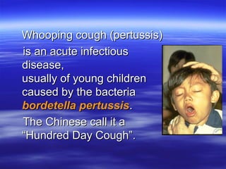 C05 P12 WHOOPING COUGH Community Medicine.ppt