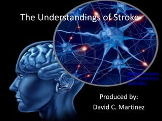 The Understandings of Stroke
Produced by:
David C. Martinez
https://www.youtu
be.com/watch?v=C
SgwB2EljBU
 
