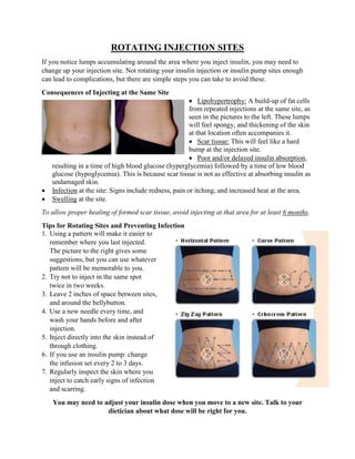 ROTATING INJECTION SITES
If you notice lumps accumulating around the area where you inject insulin, you may need to
change up your injection site. Not rotating your insulin injection or insulin pump sites enough
can lead to complications, but there are simple steps you can take to avoid these.
Consequences of Injecting at the Same Site
 Lipohypertrophy: A build-up of fat cells
from repeated injections at the same site, as
seen in the pictures to the left. These lumps
will feel spongy, and thickening of the skin
at that location often accompanies it.
 Scar tissue: This will feel like a hard
bump at the injection site.
 Poor and/or delayed insulin absorption,
resulting in a time of high blood glucose (hyperglycemia) followed by a time of low blood
glucose (hypoglycemia). This is because scar tissue is not as effective at absorbing insulin as
undamaged skin.
 Infection at the site: Signs include redness, pain or itching, and increased heat at the area.
 Swelling at the site.
To allow proper healing of formed scar tissue, avoid injecting at that area for at least 6 months.
Tips for Rotating Sites and Preventing Infection
1. Using a pattern will make it easier to
remember where you last injected.
The picture to the right gives some
suggestions, but you can use whatever
pattern will be memorable to you.
2. Try not to inject in the same spot
twice in two weeks.
3. Leave 2 inches of space between sites,
and around the bellybutton.
4. Use a new needle every time, and
wash your hands before and after
injection.
5. Inject directly into the skin instead of
through clothing.
6. If you use an insulin pump: change
the infusion set every 2 to 3 days.
7. Regularly inspect the skin where you
inject to catch early signs of infection
and scarring.
You may need to adjust your insulin dose when you move to a new site. Talk to your
dietician about what dose will be right for you.
 