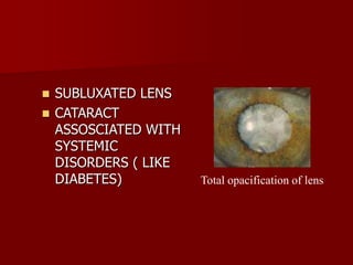  SUBLUXATED LENS
 CATARACT
ASSOSCIATED WITH
SYSTEMIC
DISORDERS ( LIKE
DIABETES) Total opacification of lens
 
