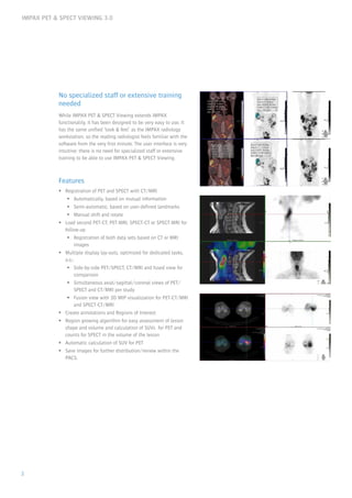 IMPAX PET & SPECT VIEWING 3.0
2
No specialized staff or extensive training
needed
While IMPAX PET & SPECT Viewing extends IMPAX
functionality, it has been designed to be very easy to use. It
has the same unified ‘look & feel’ as the IMPAX radiology
workstation, so the reading radiologist feels familiar with the
software from the very first minute. The user interface is very
intuitive: there is no need for specialized staff or extensive
training to be able to use IMPAX PET & SPECT Viewing.
Features
ƒƒ Registration of PET and SPECT with CT/MRI
ƒƒ Automatically, based on mutual information
ƒƒ Semi-automatic, based on user-defined landmarks
ƒƒ Manual shift and rotate
ƒƒ Load second PET-CT, PET-MRI, SPECT-CT or SPECT-MRI for
follow-up
ƒƒ Registration of both data sets based on CT or MRI
images
ƒƒ Multiple display lay-outs, optimized for dedicated tasks,
a.o.:
ƒƒ Side-by-side PET/SPECT, CT/MRI and fused view for
comparison
ƒƒ Simultaneous axial/sagittal/coronal views of PET/
SPECT and CT/MRI per study
ƒƒ Fusion view with 3D MIP visualization for PET-CT/MRI
and SPECT-CT/MRI
ƒƒ Create annotations and Regions of Interest
ƒƒ Region growing algorithm for easy assessment of lesion
shape and volume and calculation of SUVs for PET and
counts for SPECT in the volume of the lesion
ƒƒ Automatic calculation of SUV for PET
ƒƒ Save images for further distribution/review within the
PACS.
 