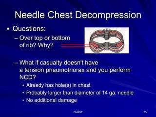 C191 w4tc cmast chest trauma management | PPS