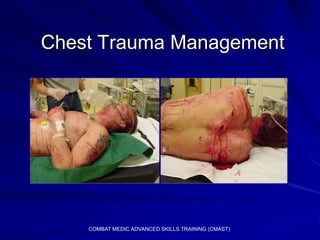 Chest Trauma Management




    COMBAT MEDIC ADVANCED SKILLS TRAINING (CMAST)
 