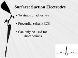 Surface: Suction Electrodes
• No   straps or adhesives

• Precordial (chest) ECG

• Can only be used for
     short periods
 