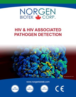 HIV & HIV ASSOCIATED
PATHOGEN DETECTION
HIV Infected H9-T cell
www.norgenbiotek.com
ISO
9001:2008
ISO
13485:2003
ISO
15189:2012
 