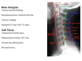 Bone Integrity
fracture/cortical buckling
Disrupted posterior vertebral body line
Anterior wedging
Disrupted C2 ring (“fat” C2 sign)
Soft Tissue
widened prevertebral space
Displaced prevertebral “fat” strip
Vacuum disc phenomenon
Deviated airway
 