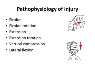 Pathophysiology of injury
• Flexion
• Flexion rotation
• Extension
• Extension rotation
• Vertical compression
• Lateral flexion
 