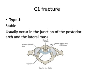 C1 fracture
• Type 1
Stable
Usually occur in the junction of the posterior
arch and the lateral mass
 