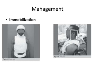 Management
• Immobilization
 