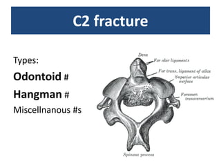 C2 fracture
Types:
Odontoid #
Hangman #
Miscellnanous #s
 