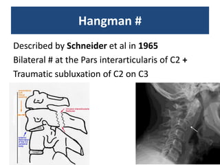 Hangman #
Described by Schneider et al in 1965
Bilateral # at the Pars interarticularis of C2 +
Traumatic subluxation of C2 on C3
 