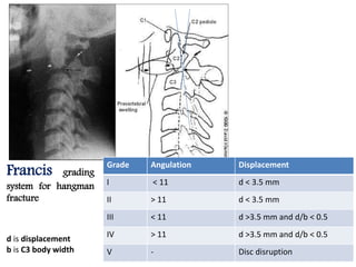 DisplacementAngulationGrade
d < 3.5 mm< 11I
d < 3.5 mm> 11II
d >3.5 mm and d/b < 0.5< 11III
d >3.5 mm and d/b < 0.5> 11IV
Disc disruption-V
d is displacement
b is C3 body width
Francis grading
system for hangman
fracture
 