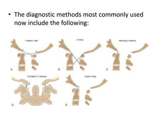 • The diagnostic methods most commonly used
now include the following:
 