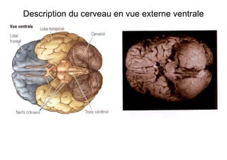 Description du cerveau en vue externe ventrale
 