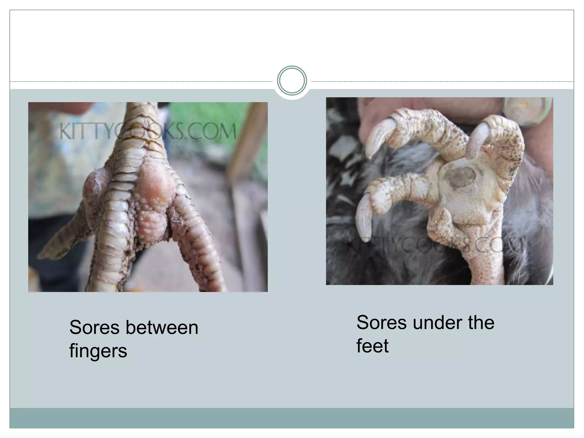 Sores between
fingers
Sores under the
feet
 