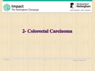 01.07.2016 Nottingham Pathology 201613
 