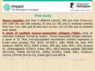 Serum samples: sera from 3 different cohorts; 200 sera from Pittsburgh,
USA (100 CRC and 100 controls), 42 sera (21 CRC and 21 matched controls)
from New York, USA, and 20 sera from Dundee, UK (10 CRC and 10 controls)
were tested.
A panel of multiple tumour-associated antigens (TAAs) using an
optimised multiplex microarray system. Tumour-associated antigen selection:
a panel of 32 TAAs (non-glycosylated recombinant proteins expressed in
E.coli) were included: P53, SOX2, NY-ESO-1, GBU, MAGE A4, HuD, AFP,
Gankyrin, GRP78, HCC1, HDGF, H-Ras1, IMP, p62, RalA, MUC1, CEA, Annexin
A1, rhUteroglobulin (CCSP1), K-Ras, APC1, APC2 blocking peptide, SDCCAG8
(NY-CO-8), TDRD6 (NY-CO-45), vWFA2 (CCSP2), ErbB2, RAF1, SCGB1A1,
CA19-9, UTP14A (NY-CO-16), K-RAS-Q61H and APC-N.
Pilot study
01.07.2016 Nottingham Pathology 201617
 