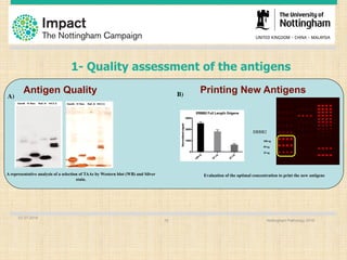 1- Quality assessment of the antigens
Antigen Quality
A representative analysis of a selection of TAAs by Western blot (WB) and Silver
stain.
A)
Printing New Antigens
Evaluation of the optimal concentration to print the new antigens
ERBB2
100 ug
50 ug
25 ug
B)
01.07.2016
Nottingham Pathology 201619
 