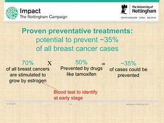 Proven preventative treatments:
potential to prevent ~35%
of all breast cancer cases
01.07.2016 Nottingham Pathology 201628
70%
of all breast cancers
are stimulated to
grow by estrogen
50%
Prevented by drugs
like tamoxifen
~35%
of cases could be
prevented
X =
Blood test to identify
at early stage
 