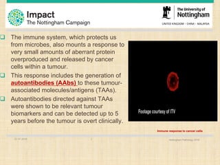 01.07.2016 Nottingham Pathology 20167
q The immune system, which protects us
from microbes, also mounts a response to
very small amounts of aberrant protein
overproduced and released by cancer
cells within a tumour.
q This response includes the generation of
autoantibodies (AAbs) to these tumour-
associated molecules/antigens (TAAs).
q Autoantibodies directed against TAAs
were shown to be relevant tumour
biomarkers and can be detected up to 5
years before the tumour is overt clinically.
Immune response to cancer cells
 