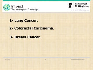 01.07.2016 Nottingham Pathology 20168
1- Lung Cancer.
2- Colorectal Carcinoma.
3- Breast Cancer.
 