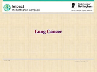 01.07.2016 Nottingham Pathology 20169
 