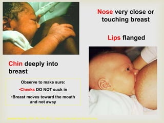 Nose very close or
touching breast
Chin deeply into
breast
Observe to make sure:
•Cheeks DO NOT suck in
•Breast moves toward the mouth
and not away
Lips flanged
Jeanette Panchula - BSW, RN, PHN, IBCLC - Solano County Health and Social Services
 