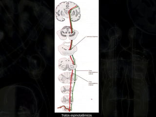 Tratos espinotalâmicos  