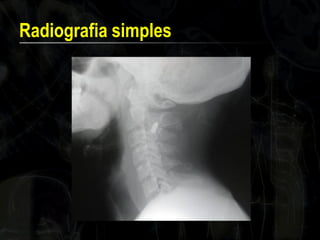 Radiografia simples  