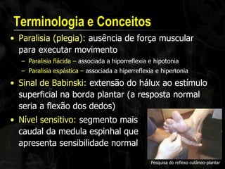 Terminologia e Conceitos 
•Paralisia (plegia): ausência de força muscular para executar movimento 
–Paralisia flácida – associada a hiporreflexia e hipotonia 
–Paralisia espástica – associada a hiperreflexia e hipertonia 
•Sinal de Babinski: extensão do hálux ao estímulo superficial na borda plantar (a resposta normal seria a flexão dos dedos) 
Pesquisa do reflexo cutâneo-plantar 
•Nível sensitivo: segmento mais caudal da medula espinhal que apresenta sensibilidade normal  