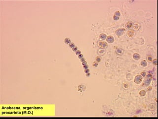 Anabaena, organismo
procariota (M.O.)
 