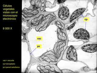 Células
vegetales
vistas con el
microscopio
electrónico                 cp


8 000 X


                      vac


                      pc




vac= vacuola
cp=cloroplasto
pc=pared celulósica
 