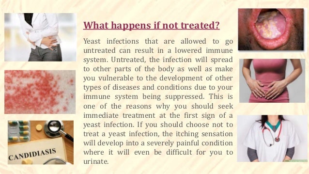 What happens when you have sex with a yeast infection pic 839