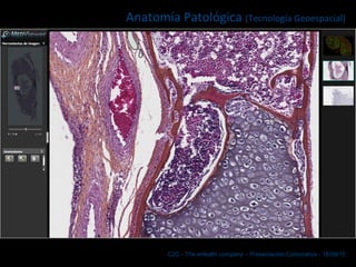 C2C - The eHealth company – Presentación Corporativa - 18/09/15
Anatomía Patológica (Tecnología Geoespacial)
 
