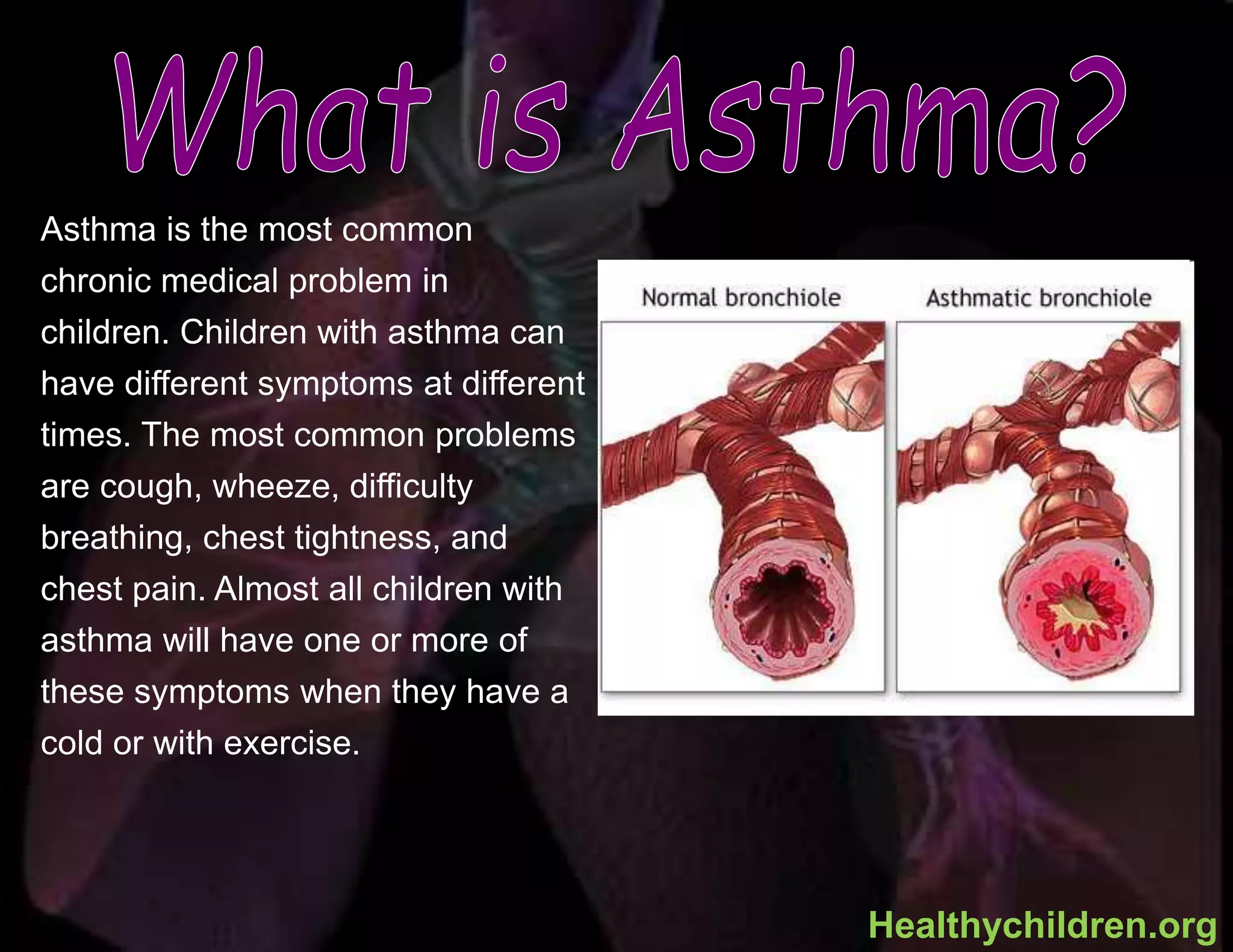 Asthma is the most common
chronic medical problem in
children. Children with asthma can
have different symptoms at different
times. The most common problems
are cough, wheeze, difficulty
breathing, chest tightness, and
chest pain. Almost all children with
asthma will have one or more of
these symptoms when they have a
cold or with exercise.
Healthychildren.org
 