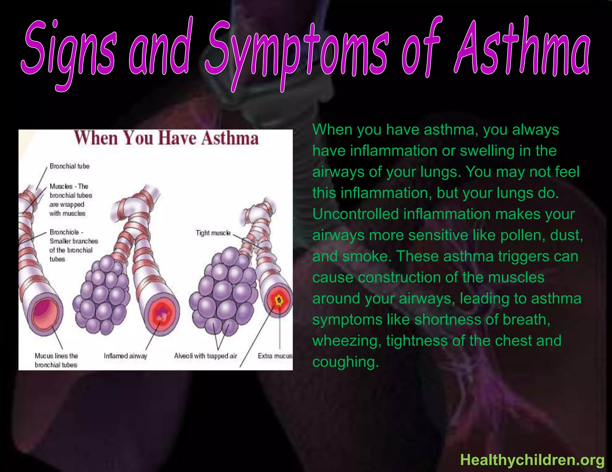 When you have asthma, you always
have inflammation or swelling in the
airways of your lungs. You may not feel
this inflammation, but your lungs do.
Uncontrolled inflammation makes your
airways more sensitive like pollen, dust,
and smoke. These asthma triggers can
cause construction of the muscles
around your airways, leading to asthma
symptoms like shortness of breath,
wheezing, tightness of the chest and
coughing.
Healthychildren.org
 