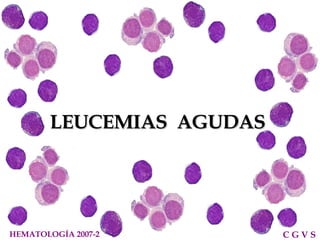 LEUCEMIAS  AGUDAS HEMATOLOGÍA 2007-2 C G V S  