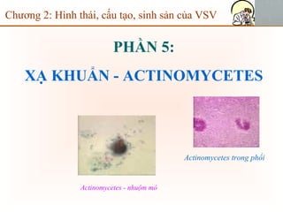 PHẦN 5:
XẠ KHUẨN - ACTINOMYCETES
Chương 2: Hình thái, cấu tạo, sinh sản của VSV
Actinomycetes - nhuộm mô
Actinomycetes trong phổi
 