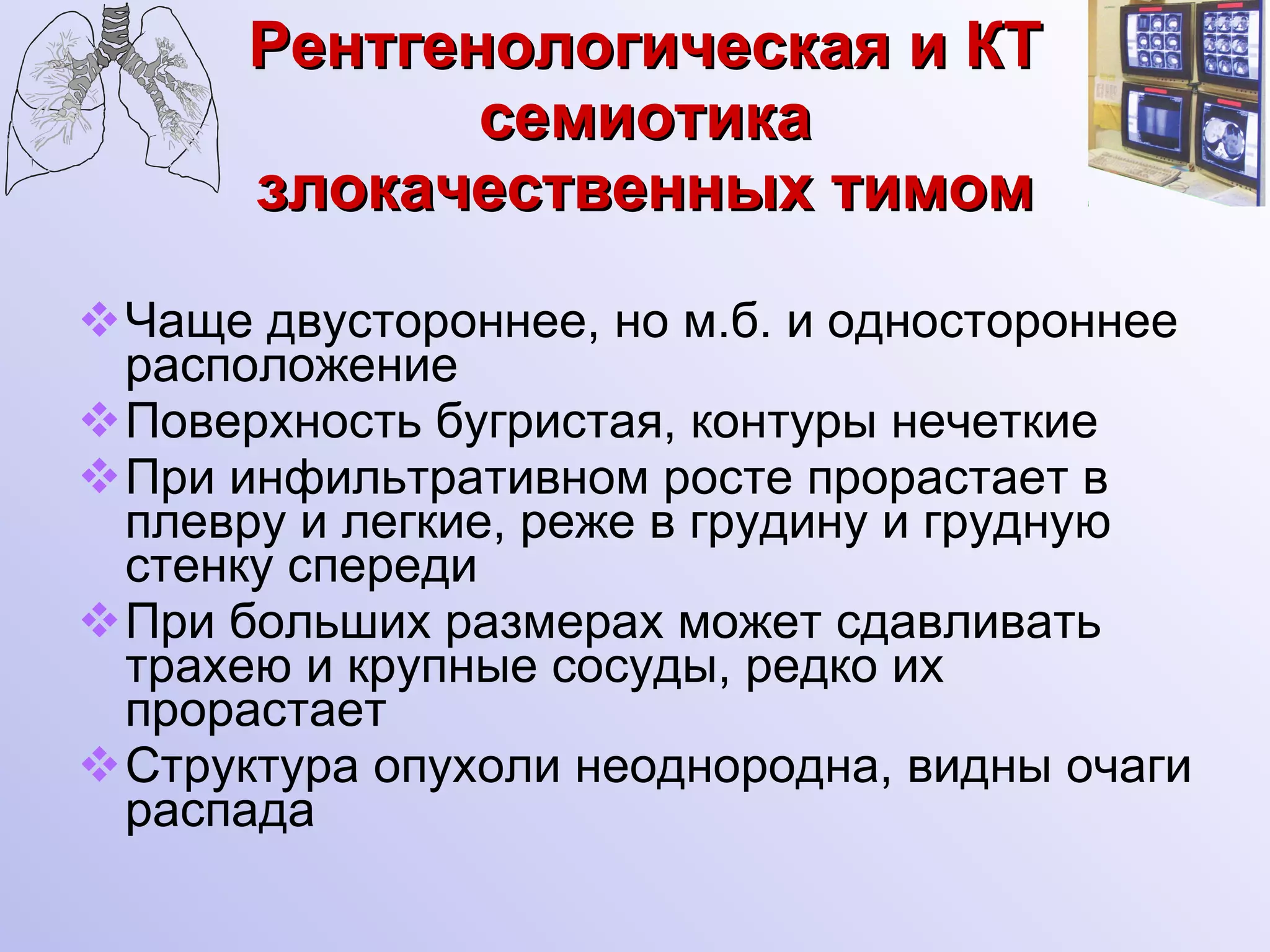 Рентгенологическая и КТ семиотика злокачественных тимом Чаще двустороннее, но м.б. и одностороннее расположение Поверхность бугристая, контуры нечеткие При инфильтративном росте прорастает в плевру и легкие, реже в грудину и грудную стенку спереди При больших размерах может сдавливать трахею и крупные сосуды, редко их прорастает Структура опухоли неоднородна, видны очаги распада 