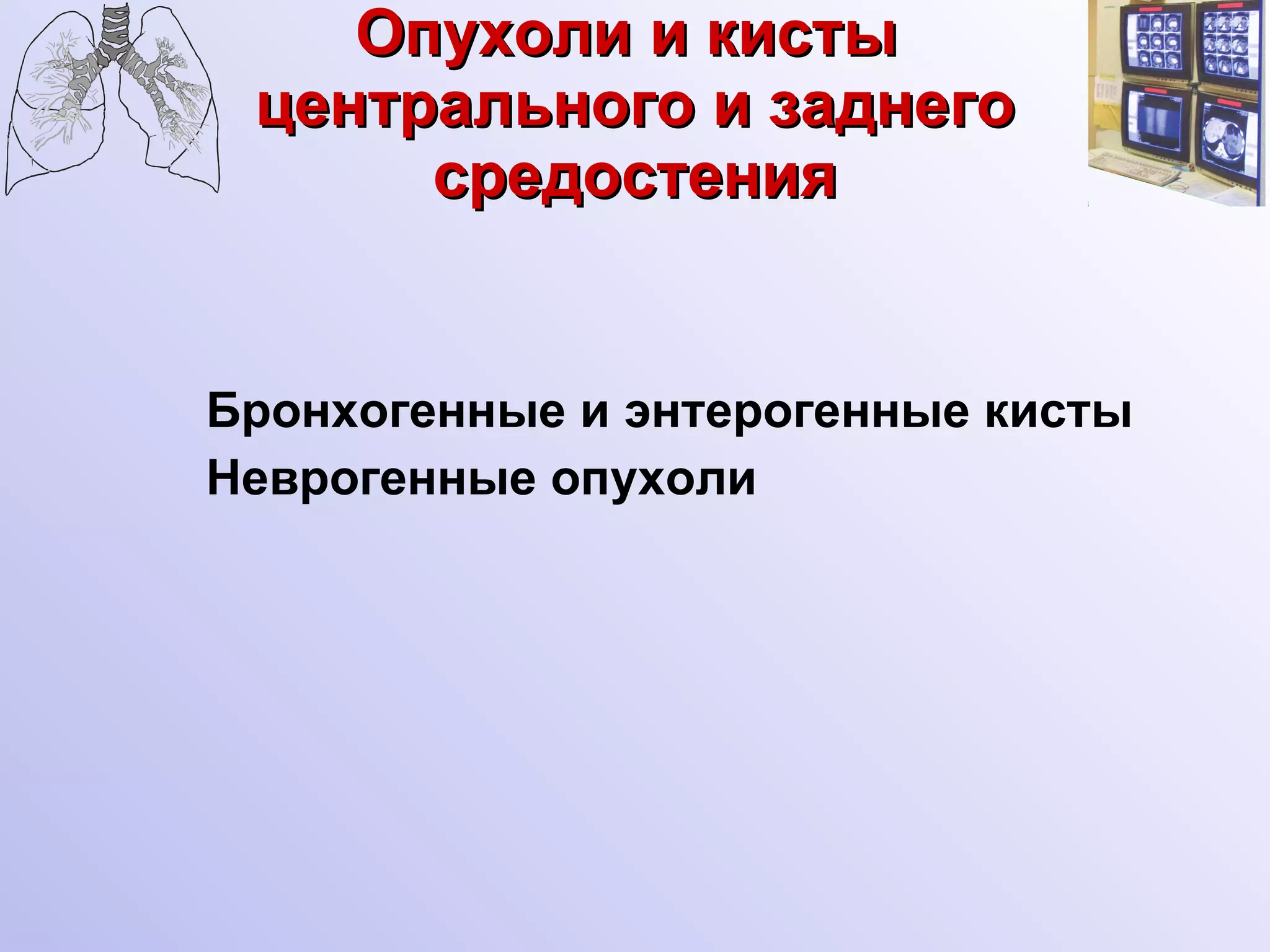 Опухоли и кисты  центрального и заднего средостения Бронхогенные и энтерогенные кисты Неврогенные опухоли 