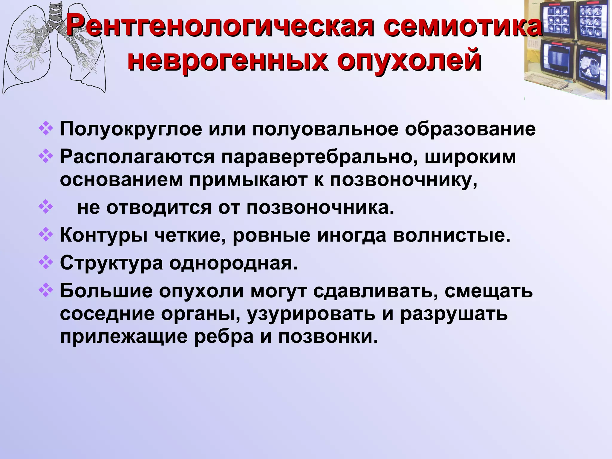 Рентгенологическая семиотика неврогенных опухолей Полуокруглое или полуовальное образование  Располагаются паравертебрально, широким основанием примыкают к позвоночнику,  не отводится от позвоночника. Контуры четкие, ровные иногда волнистые. Структура однородная. Большие опухоли могут сдавливать, смещать соседние органы, узурировать и разрушать прилежащие ребра и позвонки. 