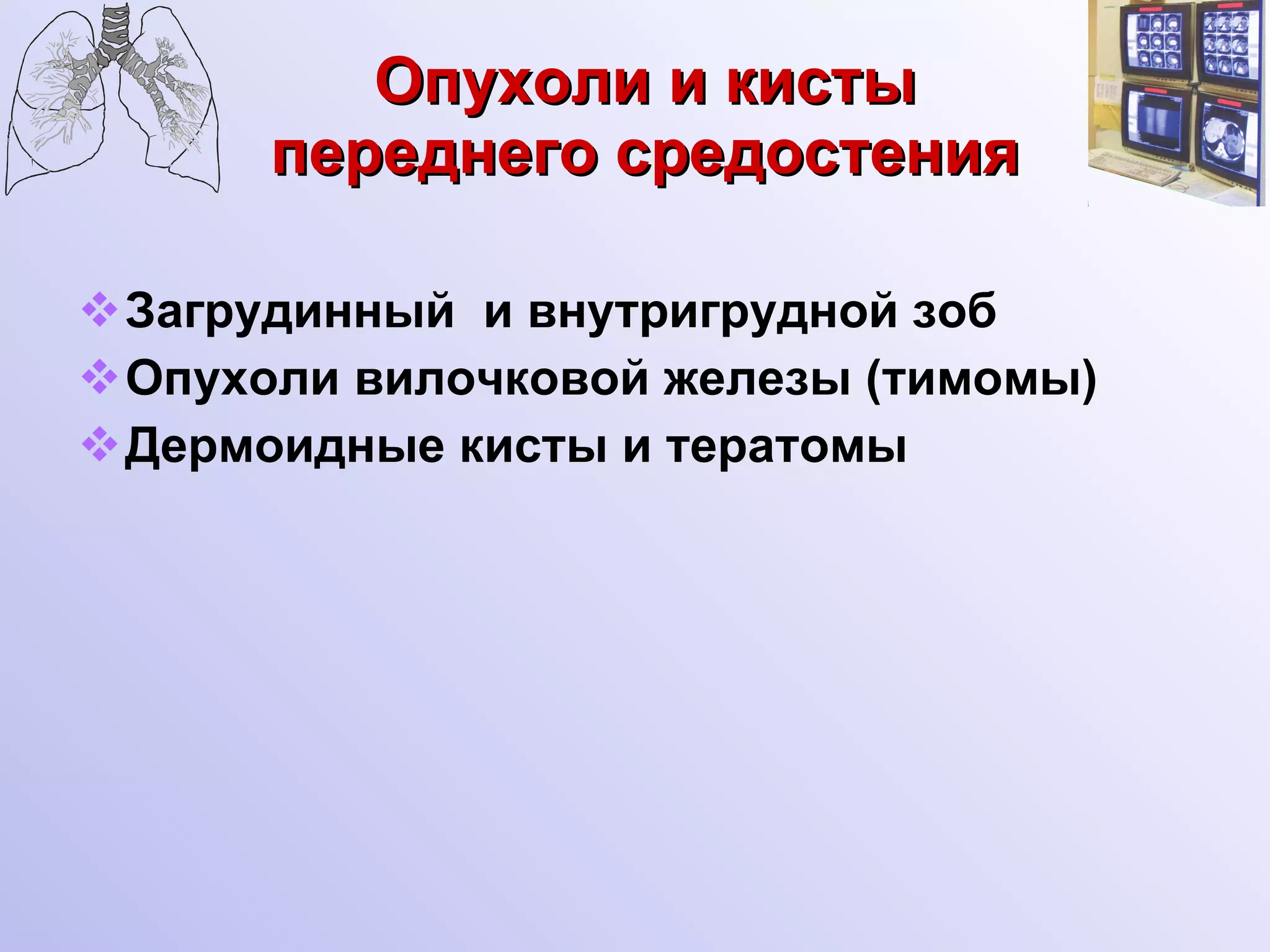 Опухоли и кисты переднего средостения Загрудинный  и внутригрудной зоб Опухоли вилочковой железы (тимомы) Дермоидные кисты и тератомы 