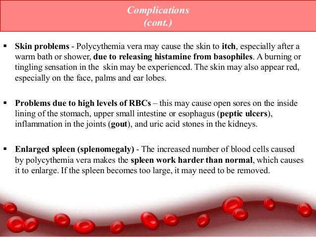 polycythemia polycythemia rubra vera